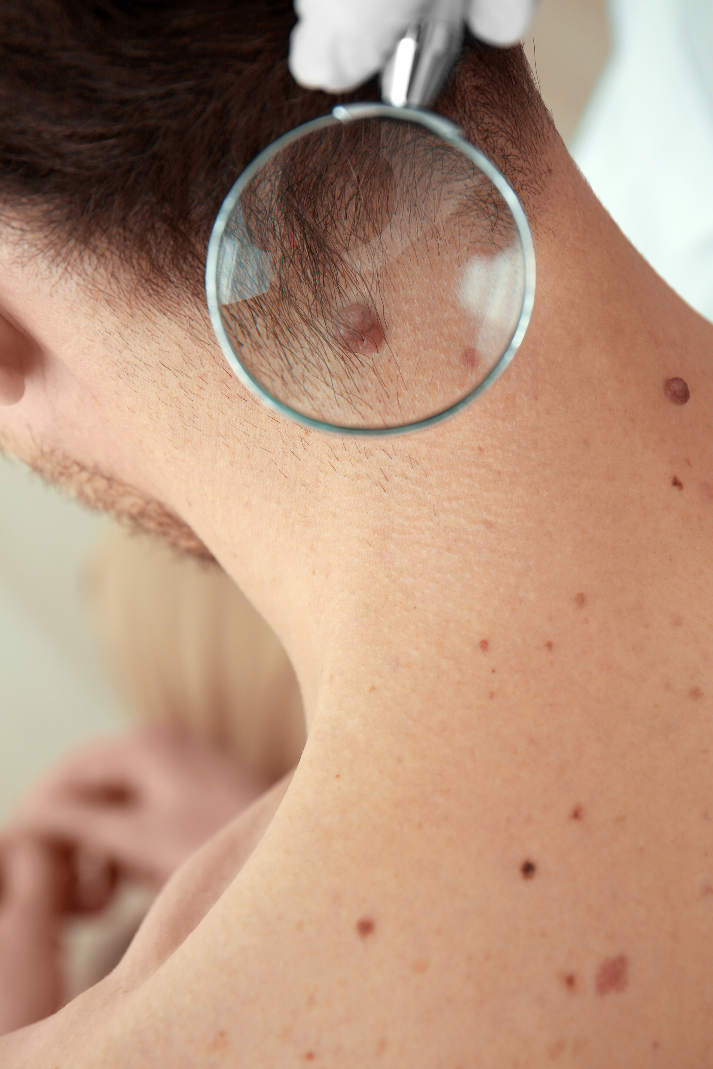 Man moisturising eyes